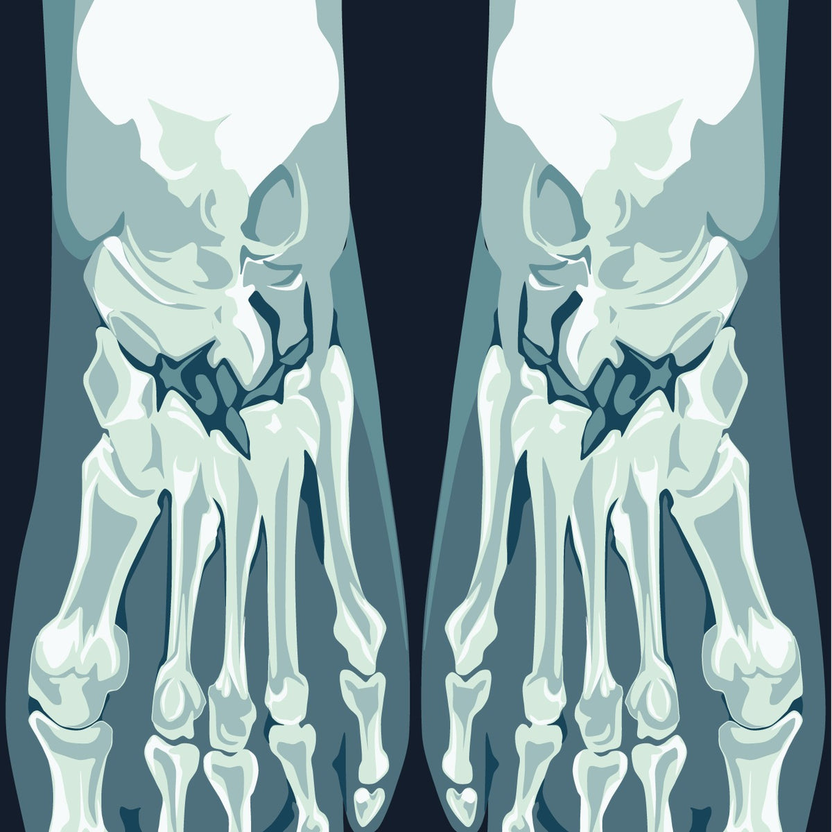 Skeletoes X-ray Crew Socks